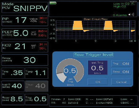 Neonatal Ventilator